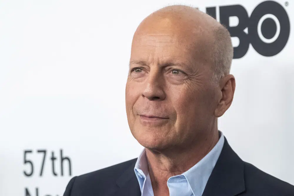 Bruce Willis has frontotemporal dementia