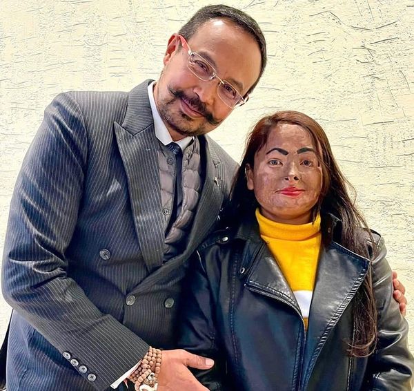 Helping out an Acid Attack Victim