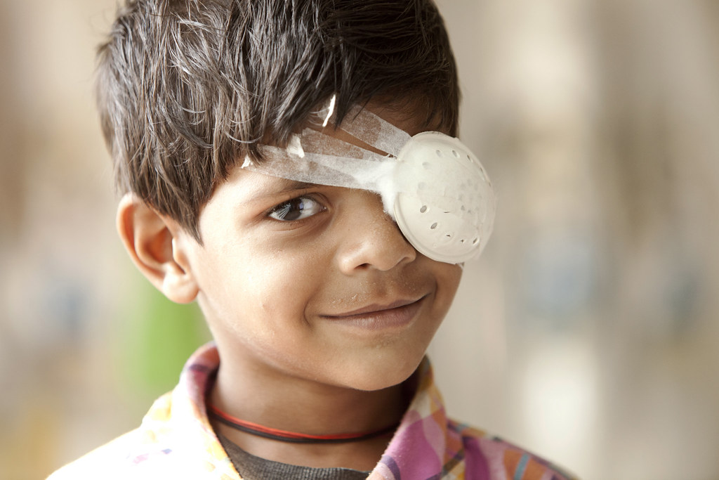 Free treatment for cataracts in Birgunj