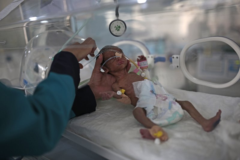 Over 2 million Yemeni children may starve in 2021