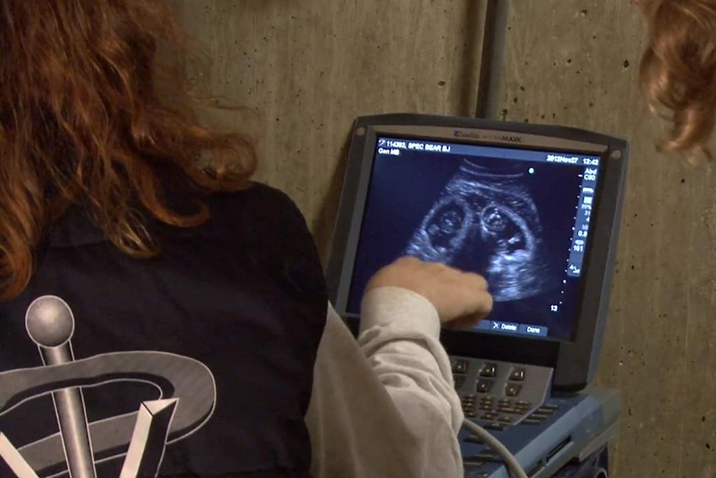 Video X-ray service in a village for pregnant women