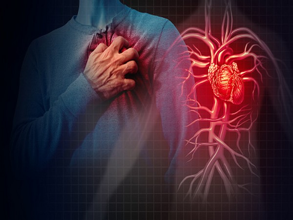 Persistent COVID infection may increase incidents of heart attacks