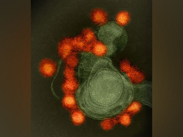 How human cells become Zika virus factories