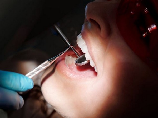 Improved mineralized material can restore tooth enamel