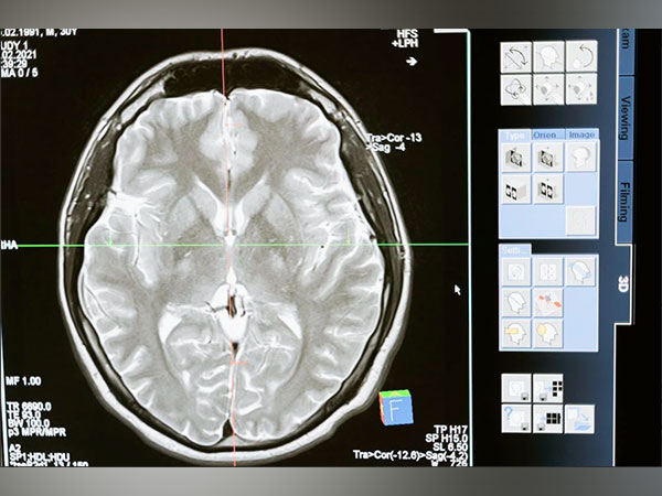 Monitoring brain waves could reduce post-op complications