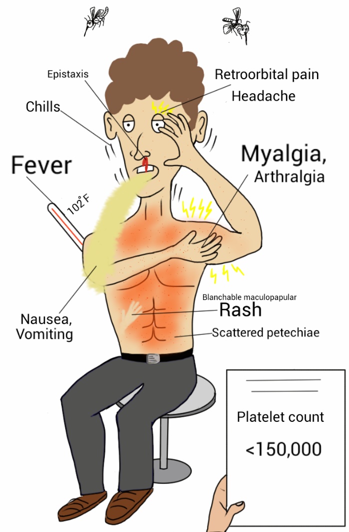 Chitwan records 76 dengue cases in a month