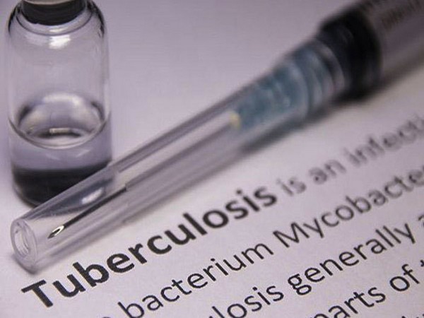 Research: Treatment length for children with tuberculosis now reduced