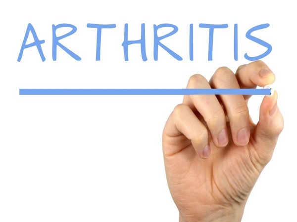 Physical activity, sleep among arthritis patients