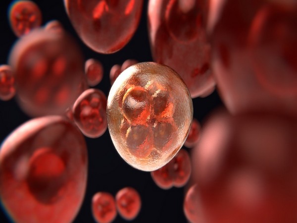 Study points to potential new therapeutic approach for leukemia