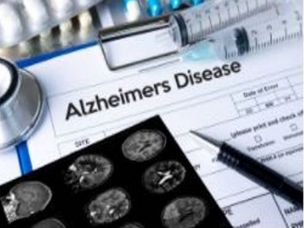 Loss of neurons makes Alzheimer’s patients drowsy: Study