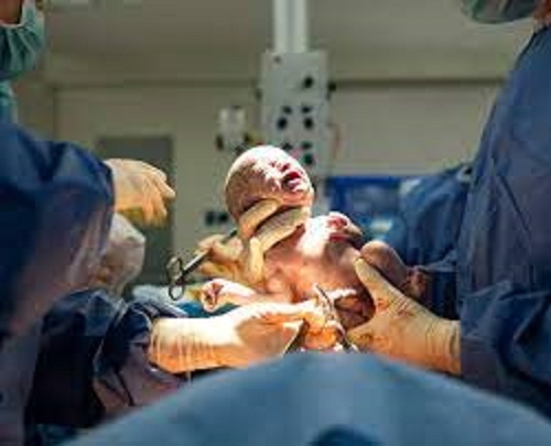 Rukum East reports first C-section birth