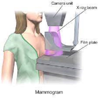 Mammography service from Dhulikhel Hospital