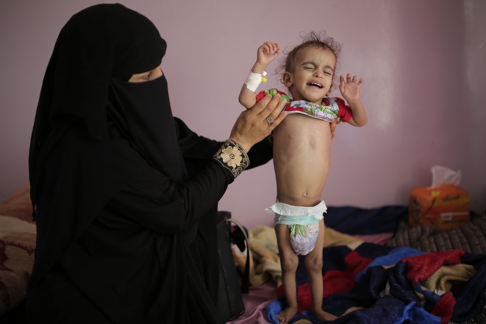 ‘This is hell’: UN food aid chief visits Yemen, fears famine