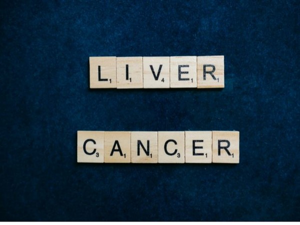 New findings may contribute to better treatment of liver cancer