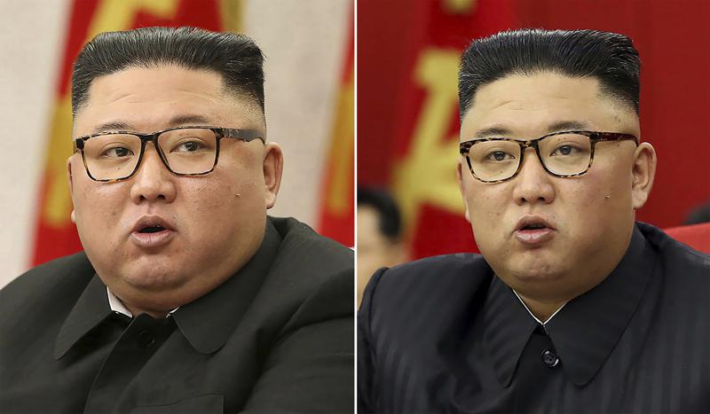 N Korea’s Kim causing health speculation