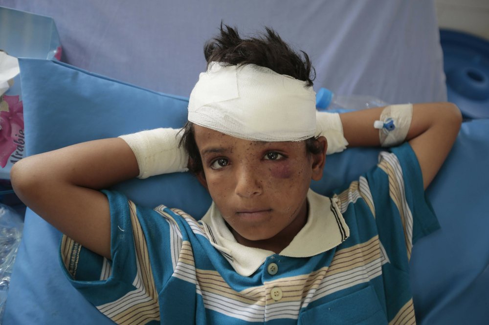 Aid agency sounds alarm over children killed in Yemen’s war