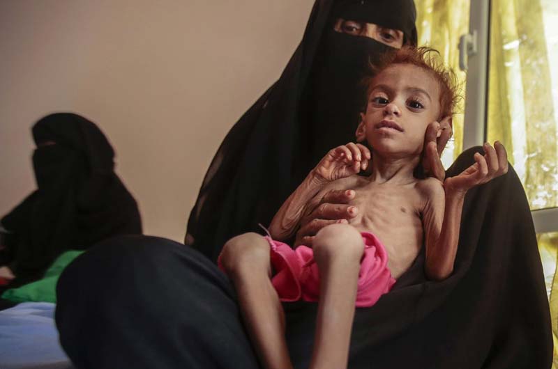 UN warns of mass famine in Yemen