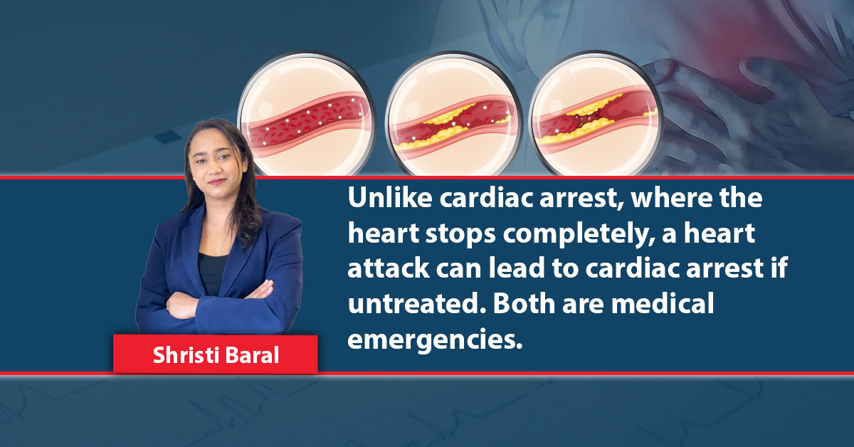 Everything You should knoww about Heart attacks