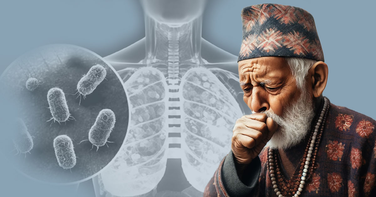 Understanding about Tuberculosis: Type,Causes,Symptoms and Treatment Options