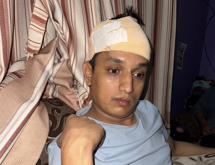 रास्वपाका सचिव भण्डारीमाथि आक्रमण