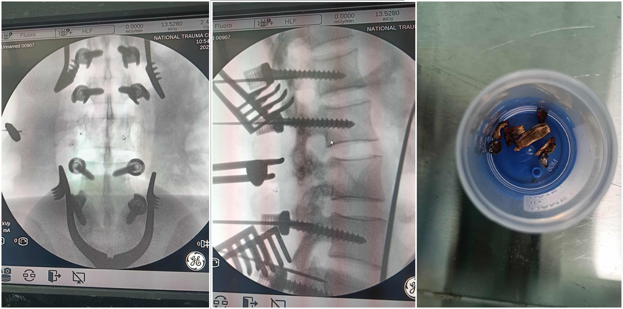 जेन-जी आन्दोलनको रिपोर्टिङले अशान्त मन
