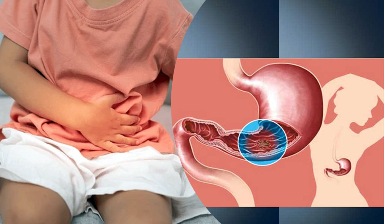 बालबालिकामा पनि हुनसक्छ ‘ग्यास्ट्रिक’